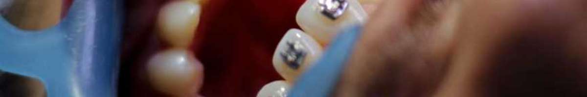 My Dentist on The Parade - Dental Braces Adelaide Banner