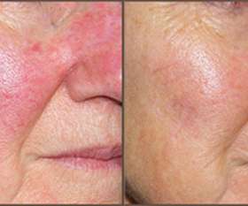 Nascent Skin and Beauty Clinic