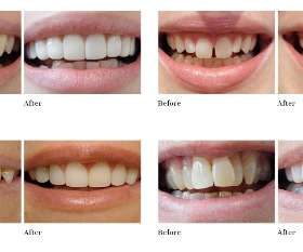 Classic Smiles Dental | Miranda Dentist