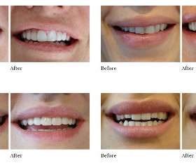 Classic Smiles Dental | Miranda Dentist