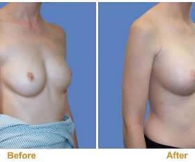 Dr Joseph Rizk Plastic Surgeon