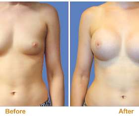 Dr Joseph Rizk Plastic Surgeon