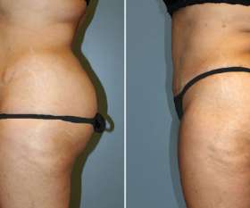 Dr Joseph Rizk Plastic Surgeon