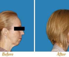 Dr Joseph Rizk Plastic Surgeon