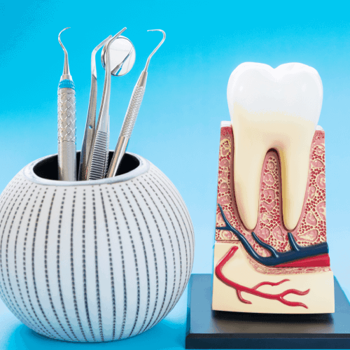 Root Canal Treatment