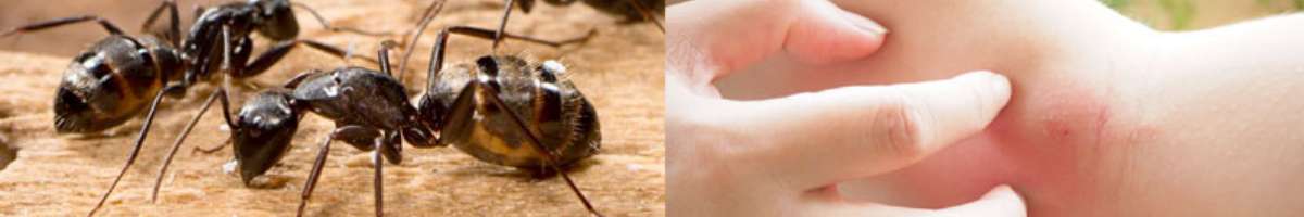 By Pest Banner