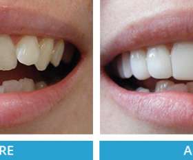 Maroondah Dental Care