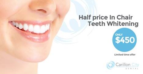 Half Price in Chair Whitening at Carillon City Dental