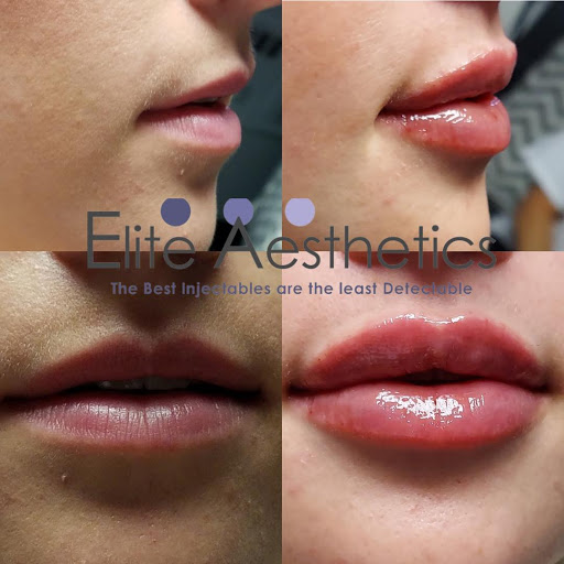 Elite Aesthetics Banner