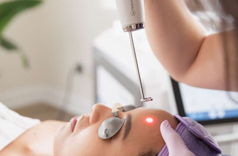 Sun Damage Skin Treatment in Toronto: Advanced MedSpa Protocols for Summer UV Recovery