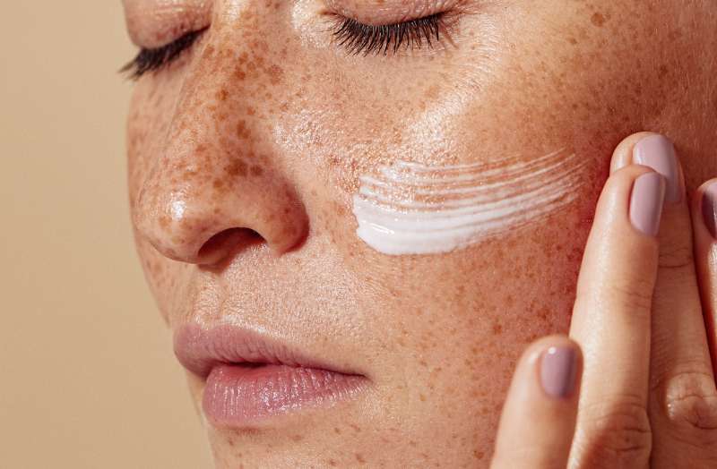 What Causes Melasma and Why Does It Keep Coming Back?