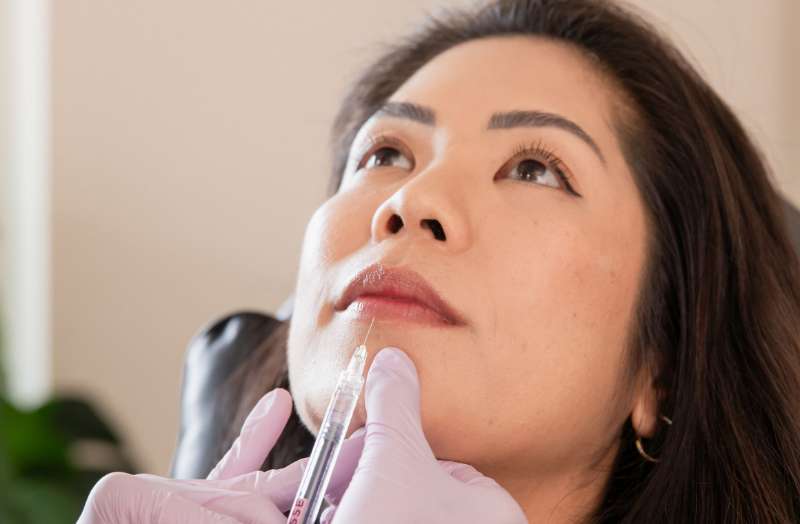 Lip Fillers for Beginners: A First-Timer's Guide