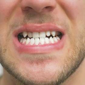 Barewolf Mens Aesthetic Clinic