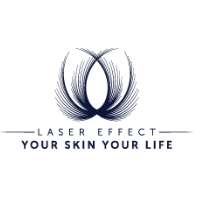 Laser Effect Logo