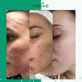 Revive Beauty Clinic