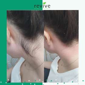 Revive Beauty Clinic