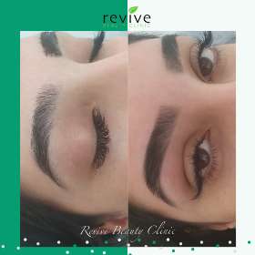 Revive Beauty Clinic