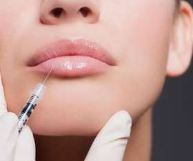 Lip Fillers Melbourne