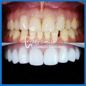 My Smile Cosmetic Dentistry