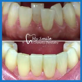 My Smile Cosmetic Dentistry