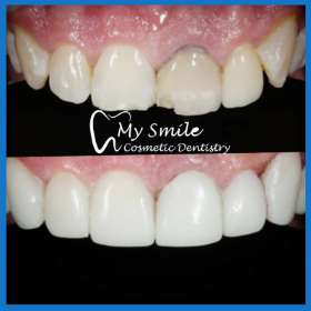 My Smile Cosmetic Dentistry