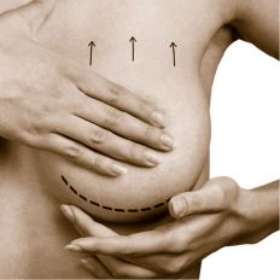 Breast & Body Clinic - Dr Michael Yunaev