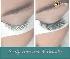 Scalp Hairline & Beauty