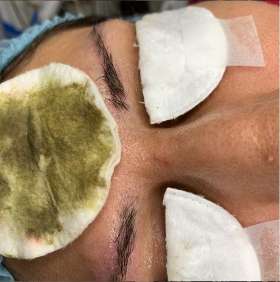 Scalp Hairline & Beauty