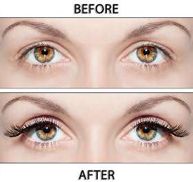 Scalp Hairline & Beauty