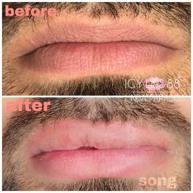 Scalp Hairline & Beauty