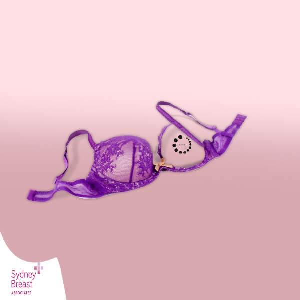 Which doctors treat breast cancer?