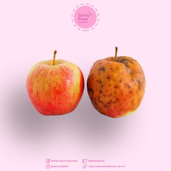 Can a healthy diet help to prevent breast cancer?