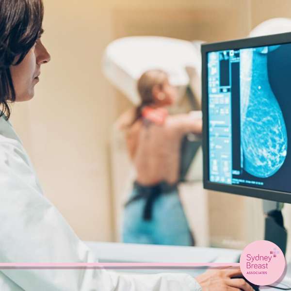 Know before you go: What to expect during your first mammogram