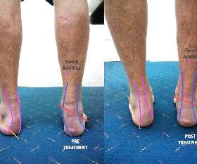 Energy In Motion Physiotherapy