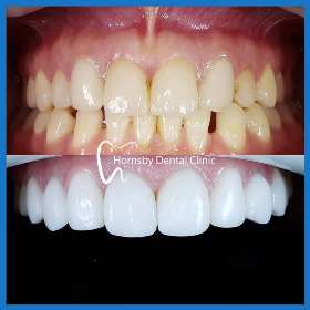 Hornsby Dental Clinic