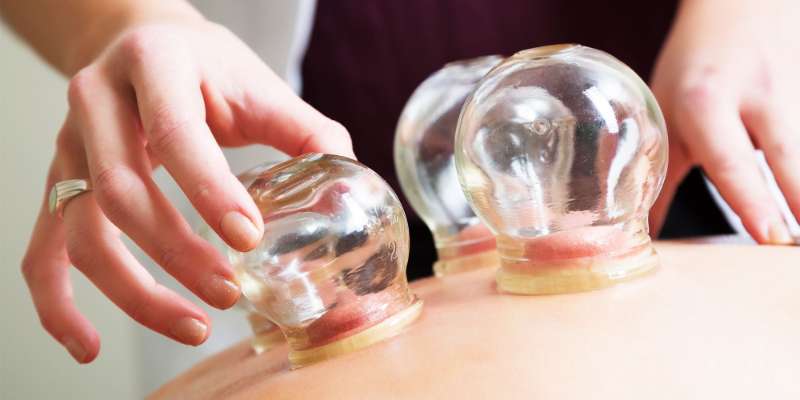 Benefit of Cupping Therapy