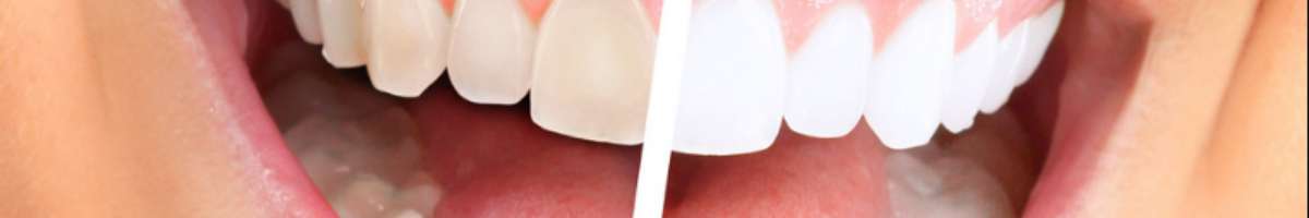 Freedom Dental Banner