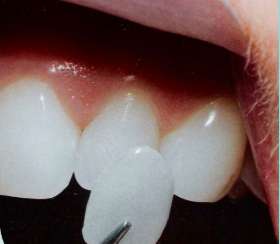 Blackburn Family Dental Care