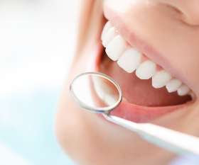 Dental Implants In Perth