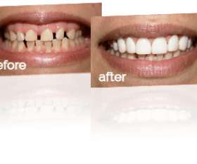 Prosmiles Dental Studio