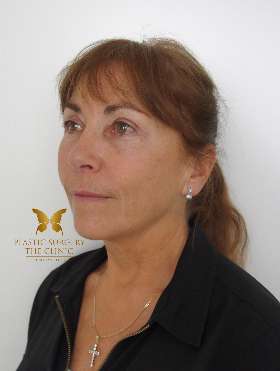 The Plastic Surgery Clinic