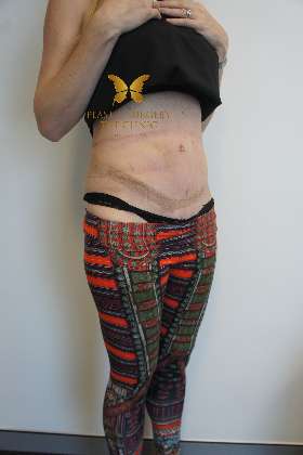 The Plastic Surgery Clinic