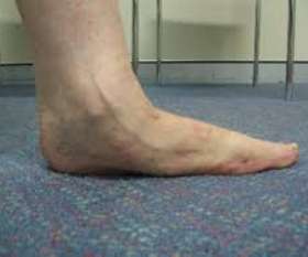 Orthotic Solutions Podiatry