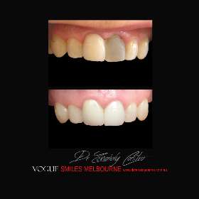 VOGUE SMILES MELBOURNE