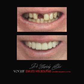 VOGUE SMILES MELBOURNE