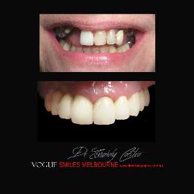 VOGUE SMILES MELBOURNE