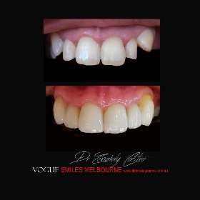 VOGUE SMILES MELBOURNE