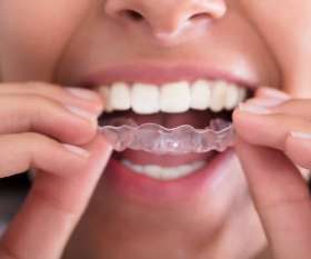 Affordable Cosmetic Dentist