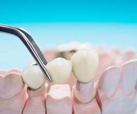 Affordable Cosmetic Dentist