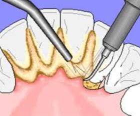 Dental Care St Kilda